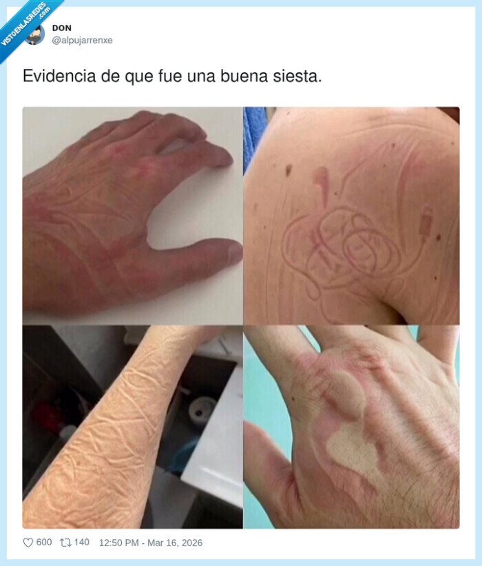 siesta,presi&oacute;n,dormir,cuerpo,marcas