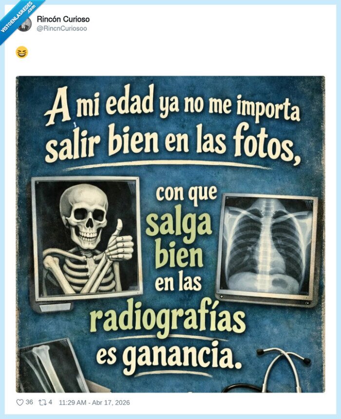 edad,fotos,radiografias,salud