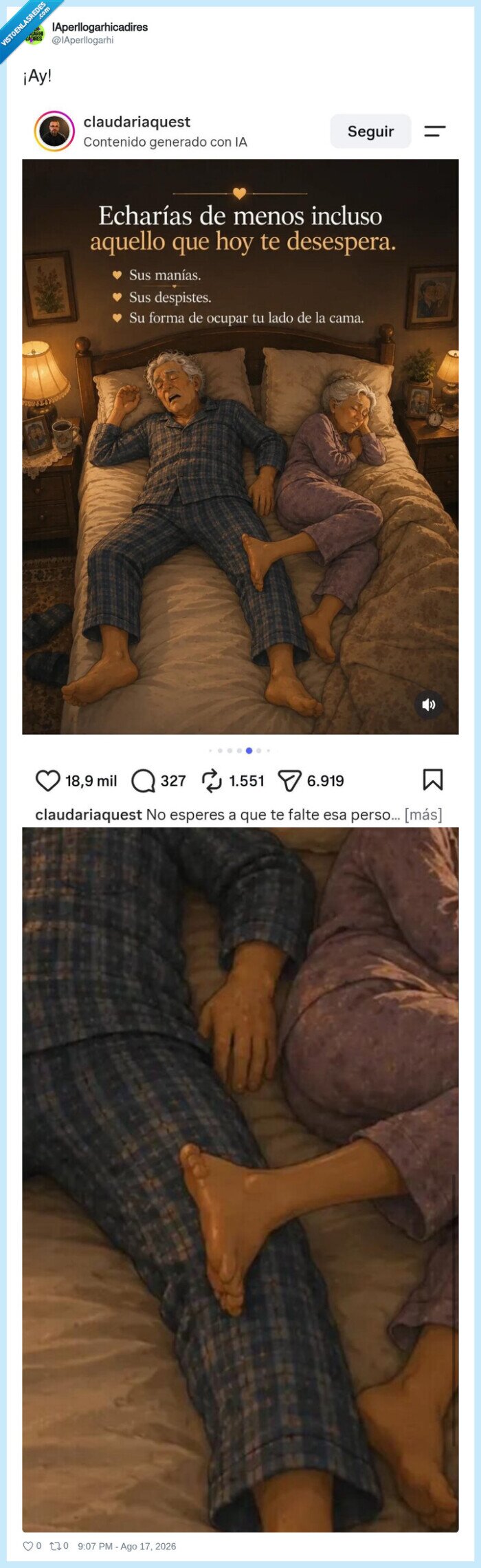 1753482 - Cuando dice que te quiere aunque tengas los pies dobles, por @IAperllogarhi