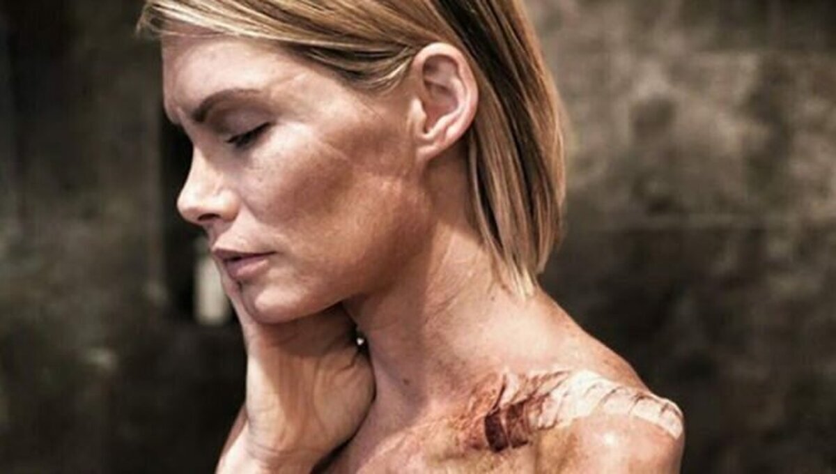 El testimonio de una especialista de Resident Evil que pierde un brazo y demanda a los productores