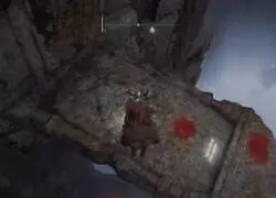 As&iacute; se ve un infarto: