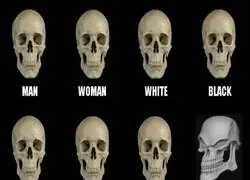 El craneo de Jim Carrey..