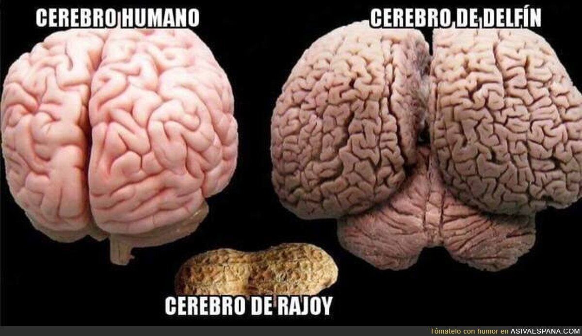 Diferentes tipos de cerebros