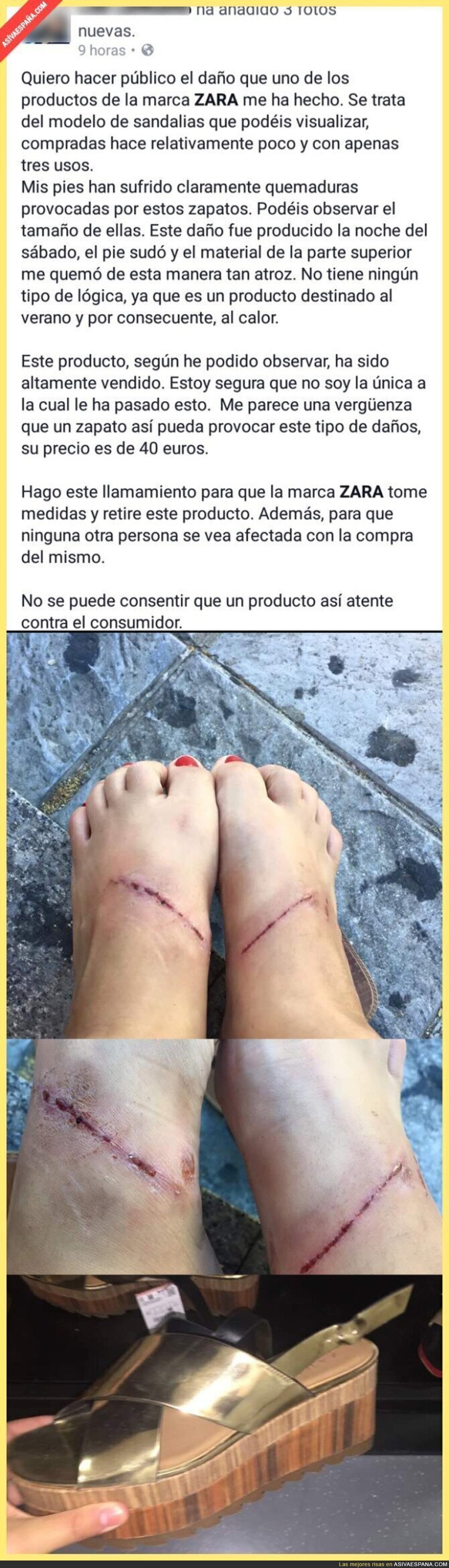 ¡OJO! Esta chica denuncia las graves heridas en los pies producidas por unos zapatos de ZARA