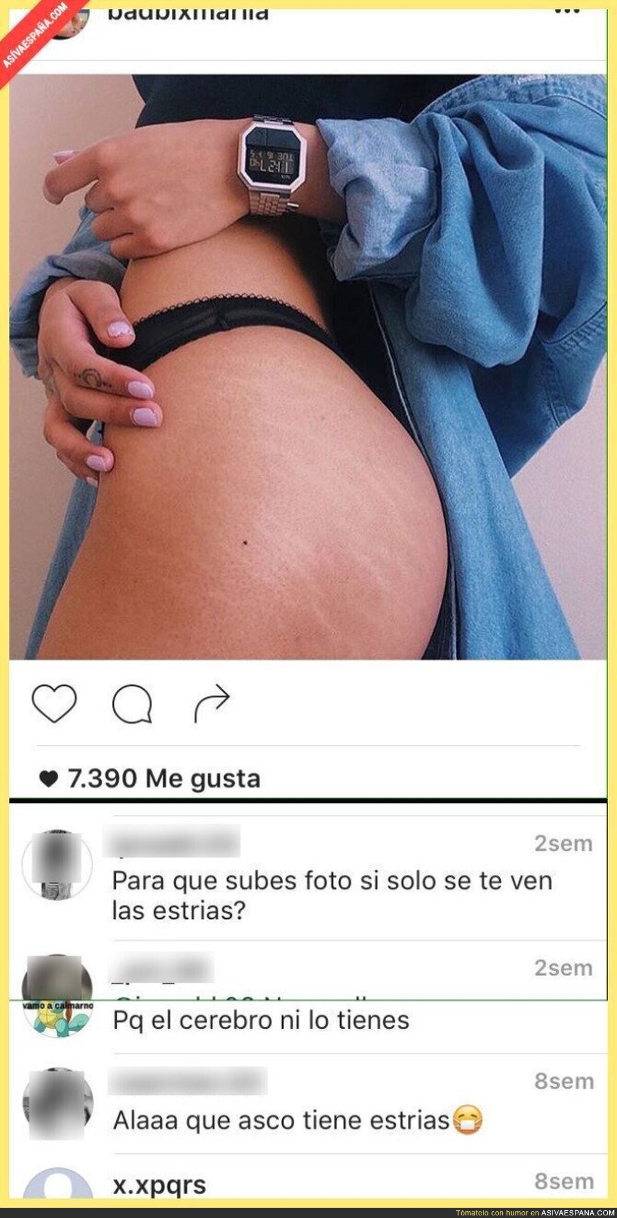Las lamentables respuestas en Instagram a una chica tras subir fotos de su cuerpo con estrías