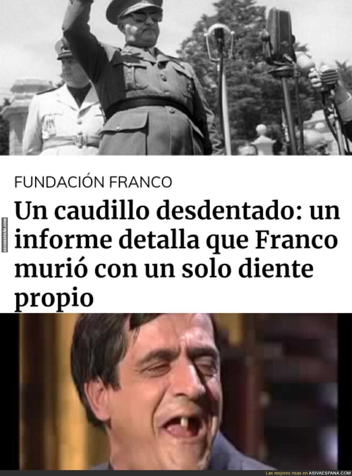 El diente de Franco