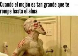 Enlace a Algunos duelen más que ciertos partos