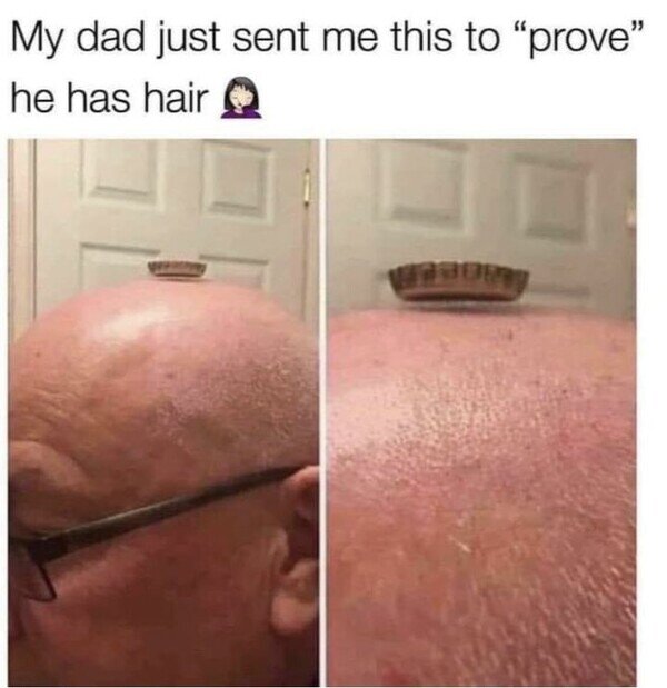 CC_2782710_9b3532a2ad52407eaba8e33a10ae5718_meme_otros_la_prueba_de_que_algo_de_pelo_hay.jpg