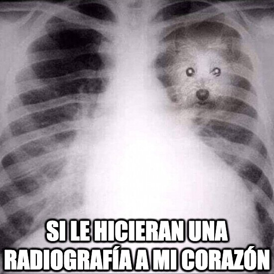 Meme_otros - Si le hicieran una radiografía a mi corazón