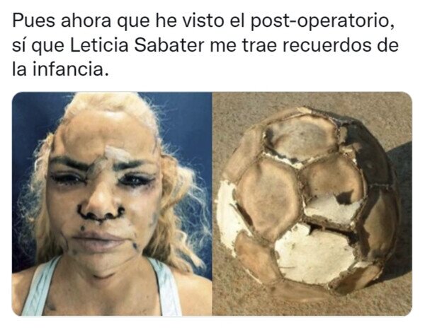 Otros - Leticia Sabater se ha operado la cara