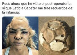 Enlace a Leticia Sabater se ha operado la cara