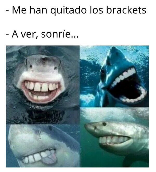 brackets,dentadura,dientes,quitar,tiburón