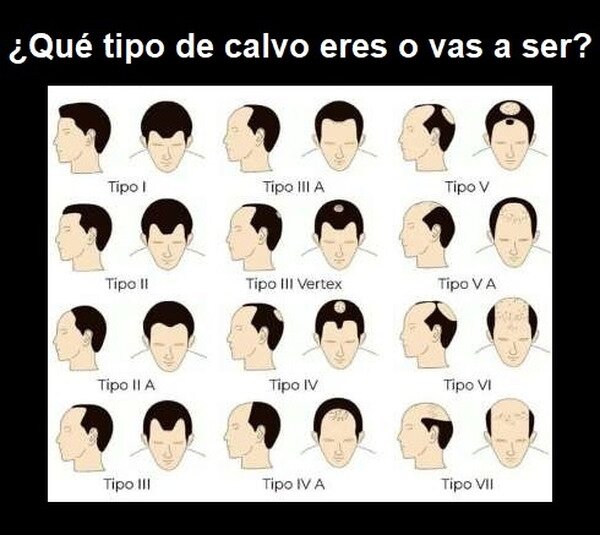Meme_otros - Tipos de alopecia...