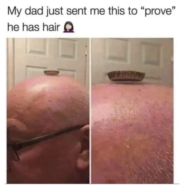 Meme_otros - La prueba de que mi padre tiene pelo