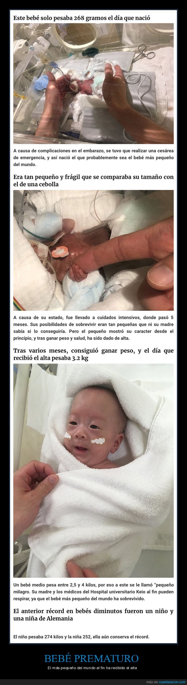 Cuanta Razon Tras Pasar Meses En El Hospital El Bebe Prematuro Superviviente Mas Pequeno Del Mundo Al Fin Ha Recibido El Alta Cuanta Razon Tras Pasar Meses En El Hospital El Bebe Prematuro Superviviente Mas Pequeno Del Mundo Al Fin Ha Recibido El Alta