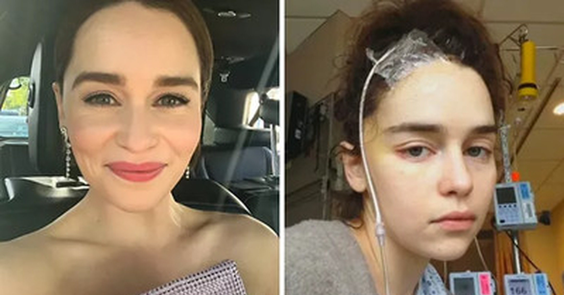 ¡Cuánta razón! / Emilia Clarke comparte 5 fotos nunca ...