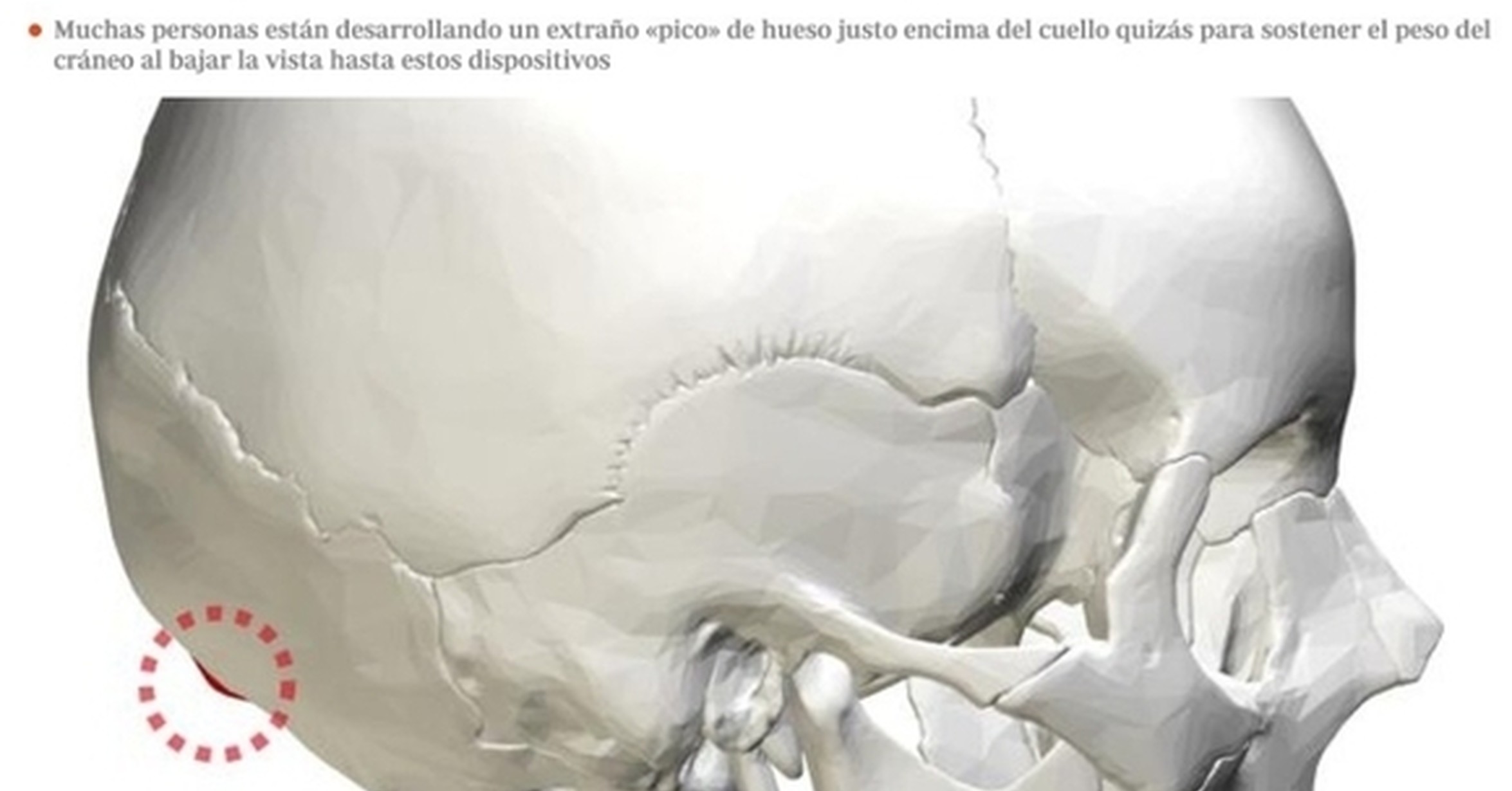 сосцевидные отростки височных костей воспаление. боль в височной кости. боль в височной кости. боль в височной кости. височно челюстной сустав артроз симптомы.