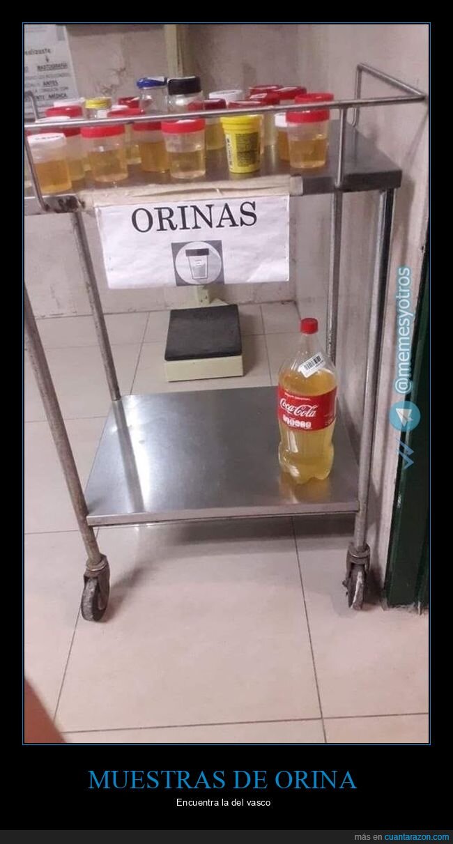 muestras,orina,tarros,botella,wtf