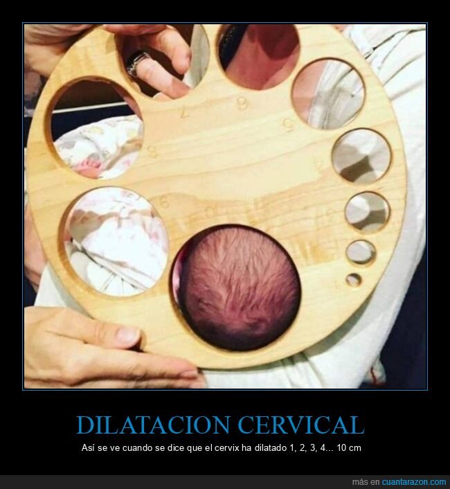 dilatación cervical,cervix,dilatar,cabeza,bebé