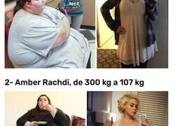 Enlace a Imágenes del giro radical de personas que han perdido más de 200kg
