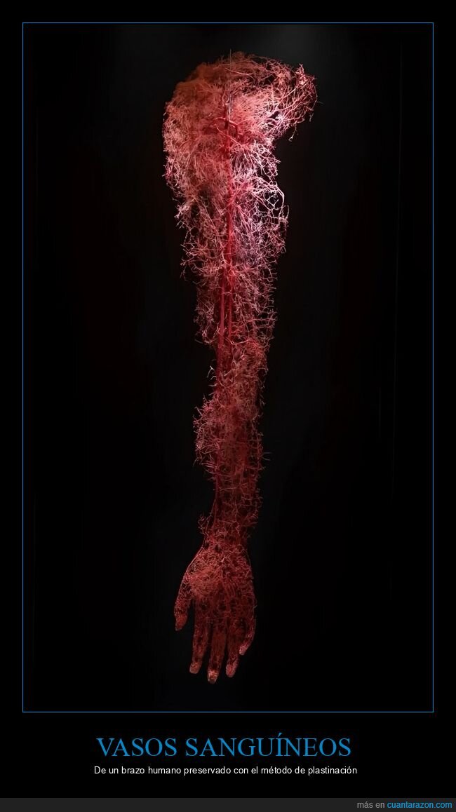vasos sanguineos,brazo,preservado,plastinación