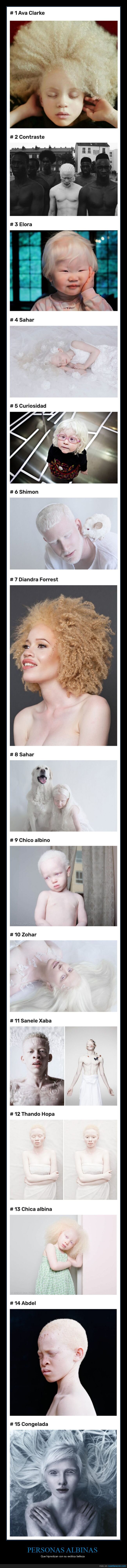 albinos,belleza