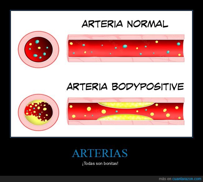 arterias,normal,bodypositive