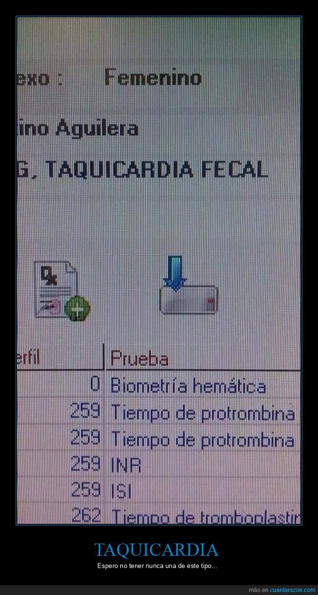 fails,taquicardia fecal,wtf