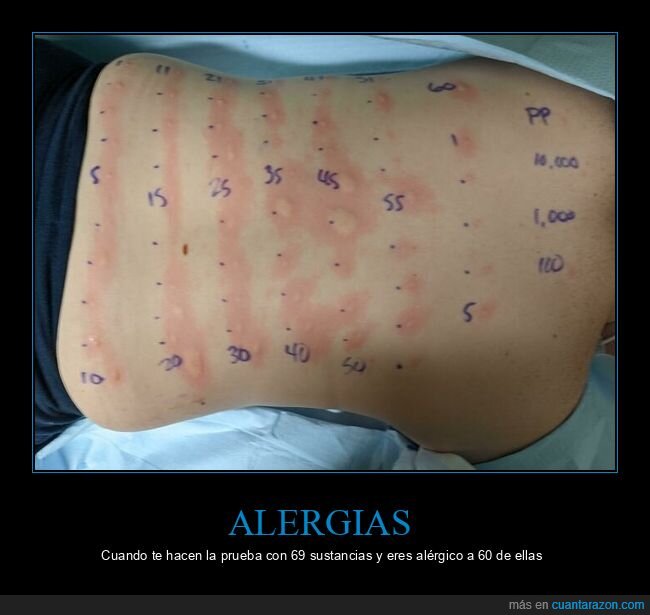 espalda,alergia,test,rojo