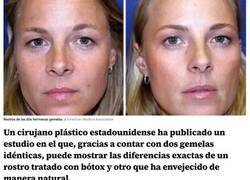 Enlace a Un cirujano plástico comparte las fotos de dos gemelas idénticas, una tratada con bótox y otra no