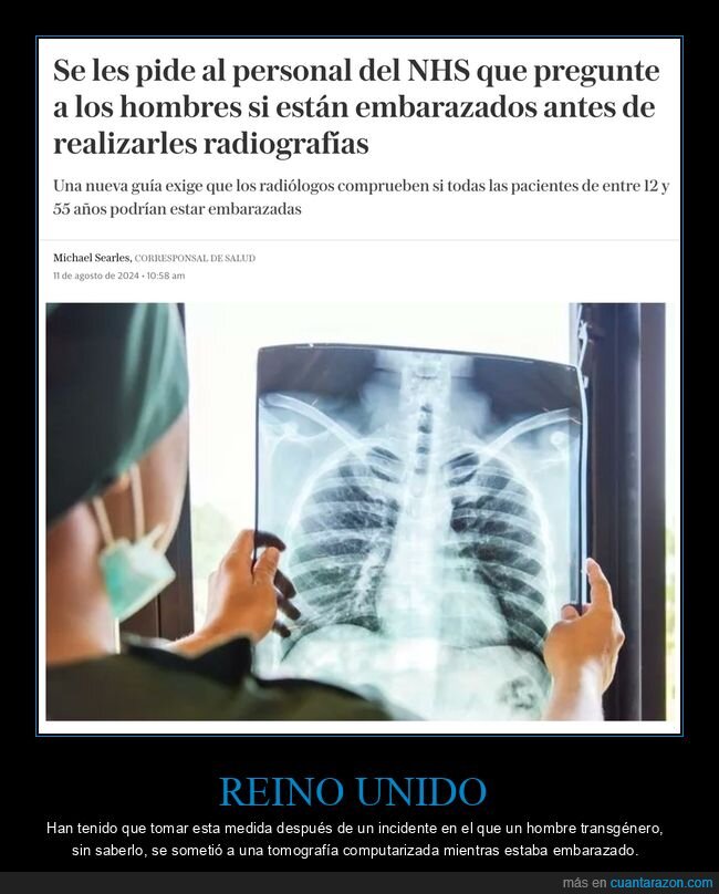 hombres,embarazados,rediografías