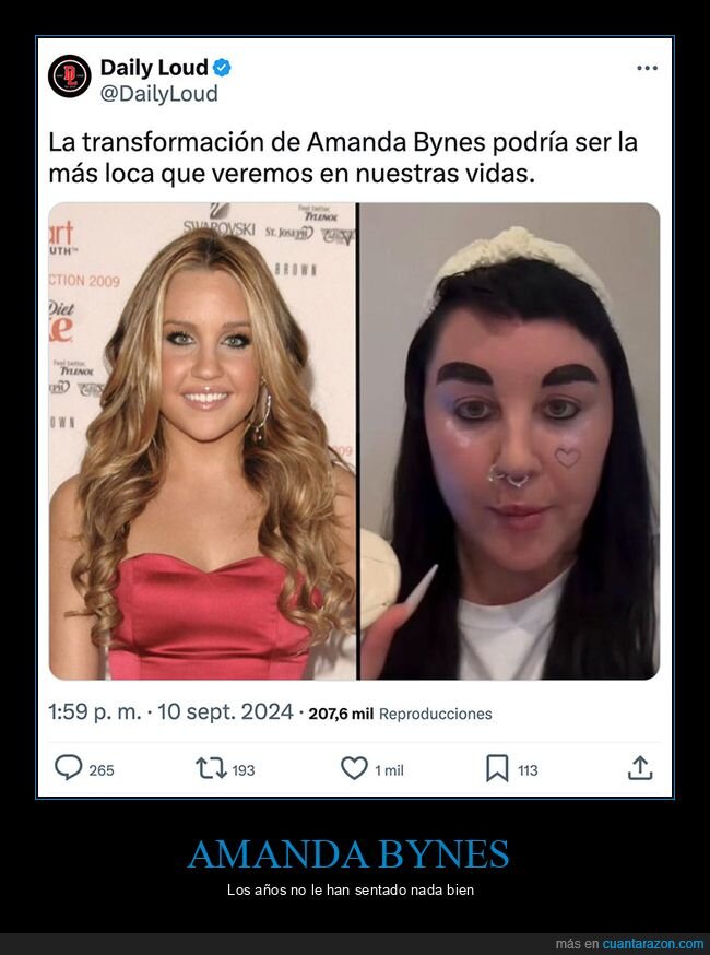 amanda bynes,antes,después,transformación