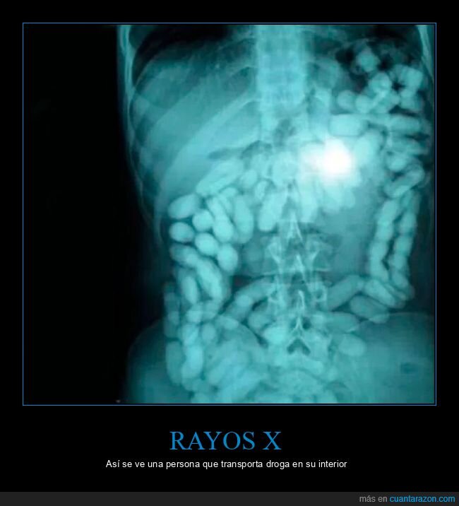 rayos x,droga