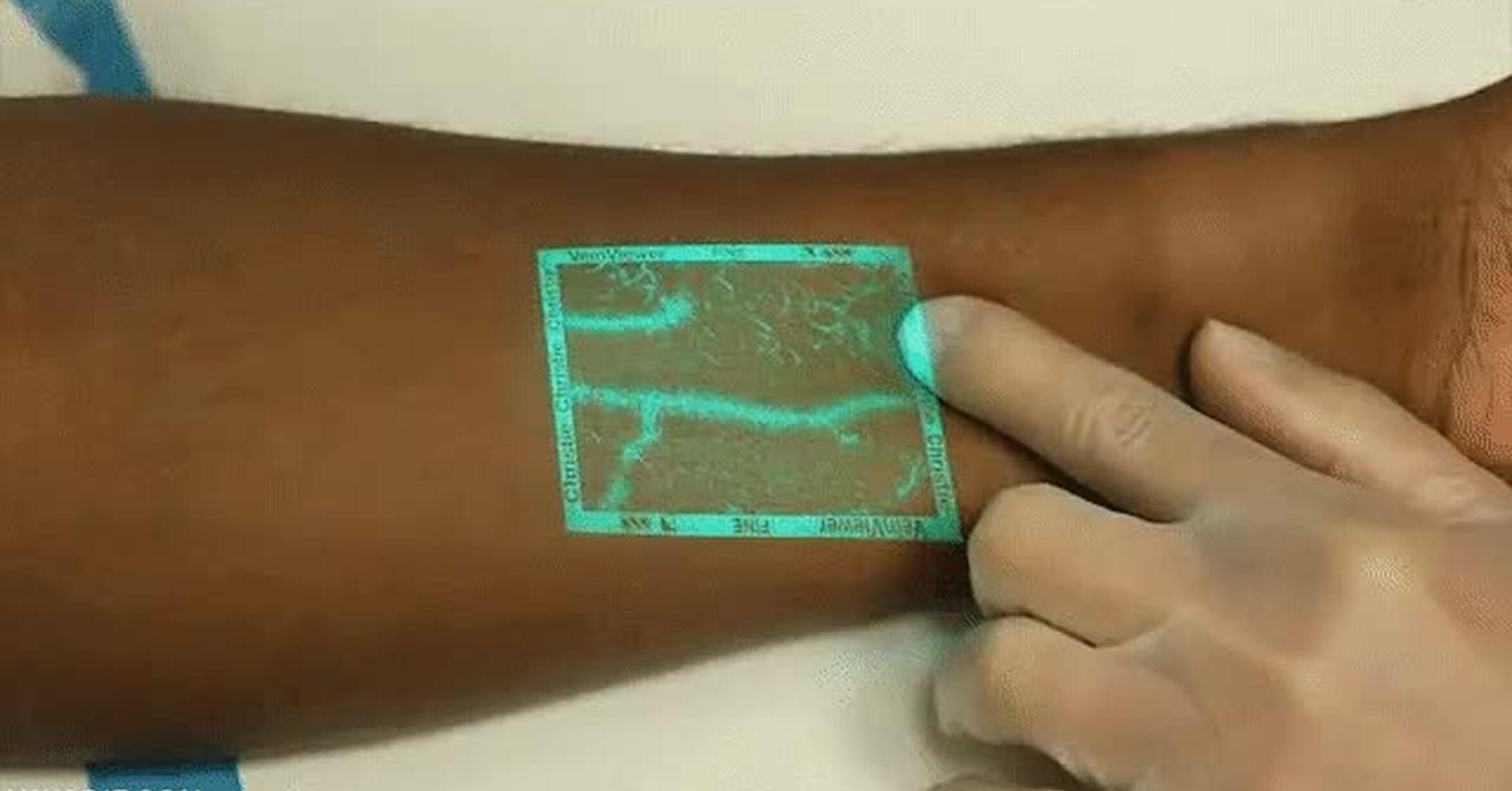 ¡Vaya GIF! / Realidad aumentada que permite a los médicos ver las venas