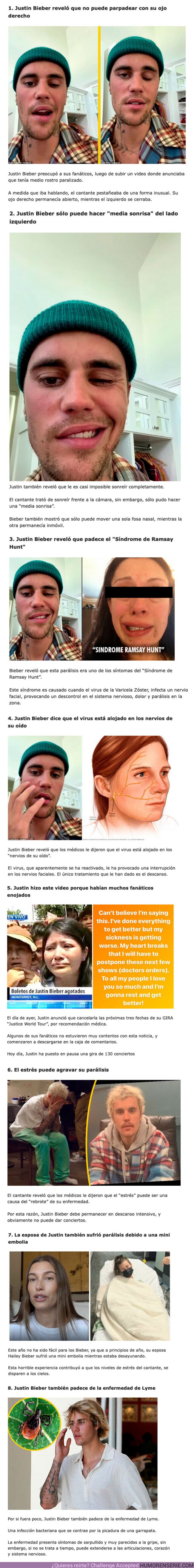 101547 - GALERÍA: Justin Bieber reveló que tiene medio rostro paralizado: 8 cosas que debes saber sobre su enfermedad