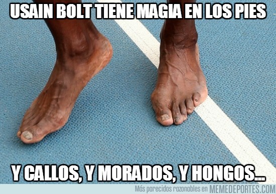 Memedeportes Usain Bolt Tiene Magia En Los Pies