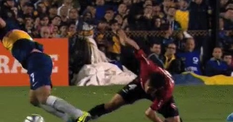Gif Tremenda Lesion En Futbol Argentino Que Duele Con Solo Verla