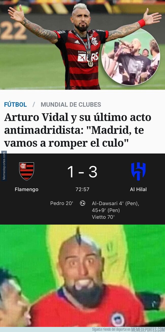 1180740 - Arturo Vidal volvió a abrir demasiado la boca