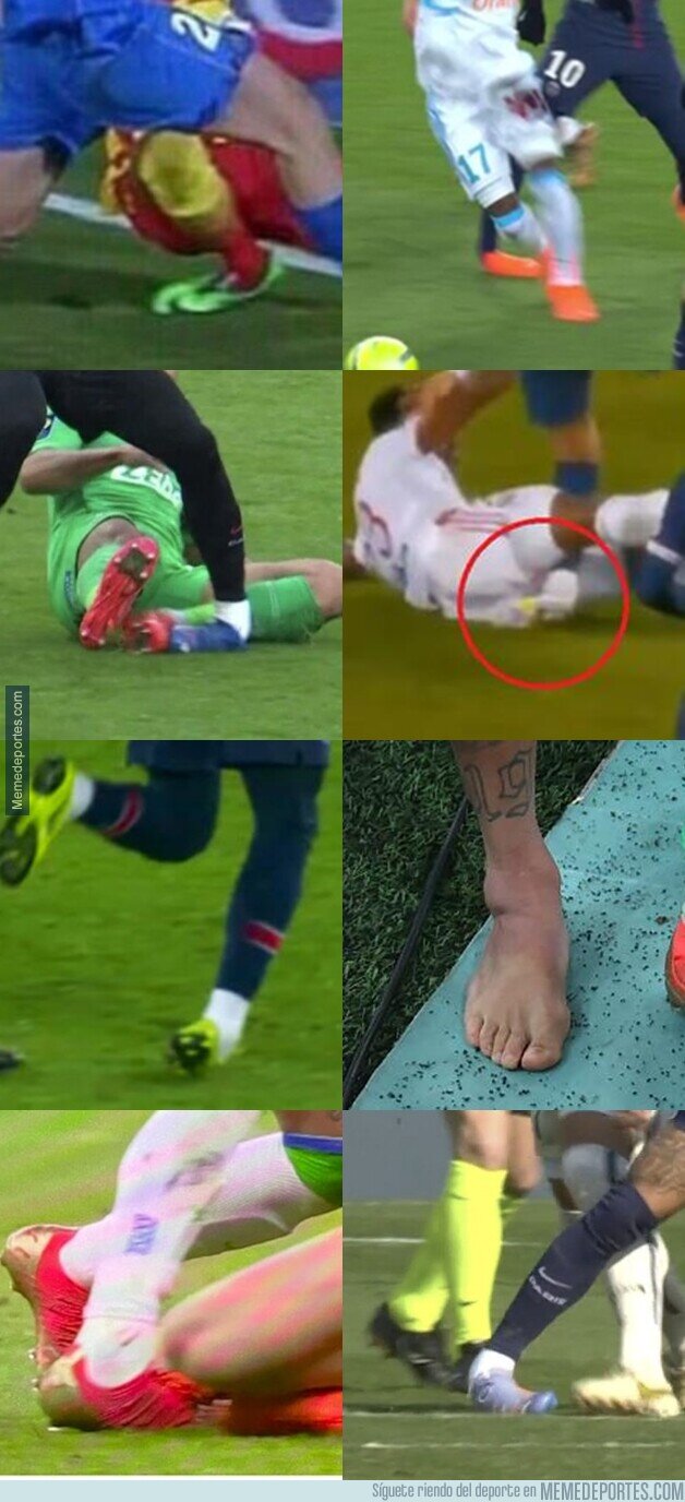 1181697 - Este collage sobre el tobillo de Neymar solo se hace más largo