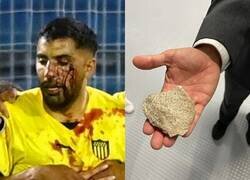 Enlace a Lio en la Libertadores con este jugador de Peñarol agredido por una piedra en partido contra Rosario
