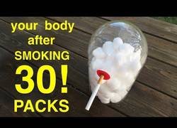Enlace a El resultado de fumar 30 paquetes de cigarrillos