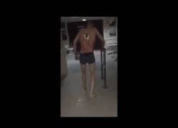 Enlace a Un paciente en Rusia ingresa por una puñalada en la espalda y sale del hospital para fumar [Abstenerse sensibles]