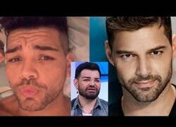 Enlace a El hombre que se operó la cara para parecerse a Ricky Martin
