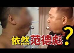 Enlace a Hombre japonés acude al hospital con una bombilla atascada en la boca tras probar un reto viral