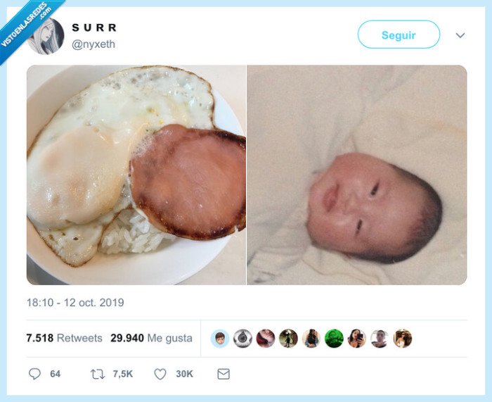 huevo,bebé,miopia,borroso