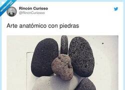 Enlace a Cuando tienes piedras en el riñón… y en el resto de órganos, por @RincnCuriosoo