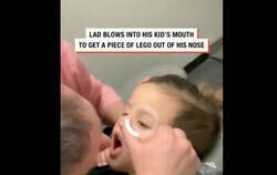 Enlace a Sopla en la boca de un niño para intentar sacar una pieza de lego que se le había quedado atascada en la nariz