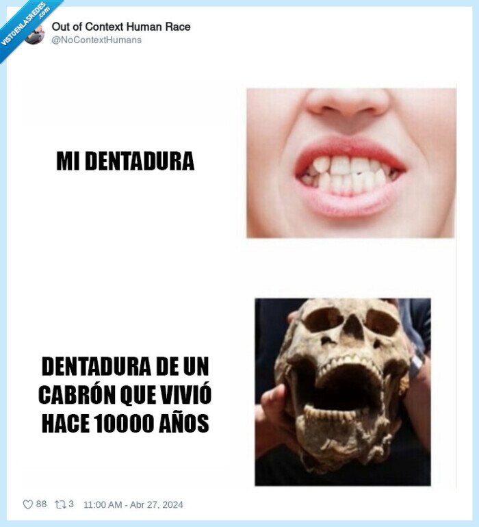 dentadura,dientes,neandertal
