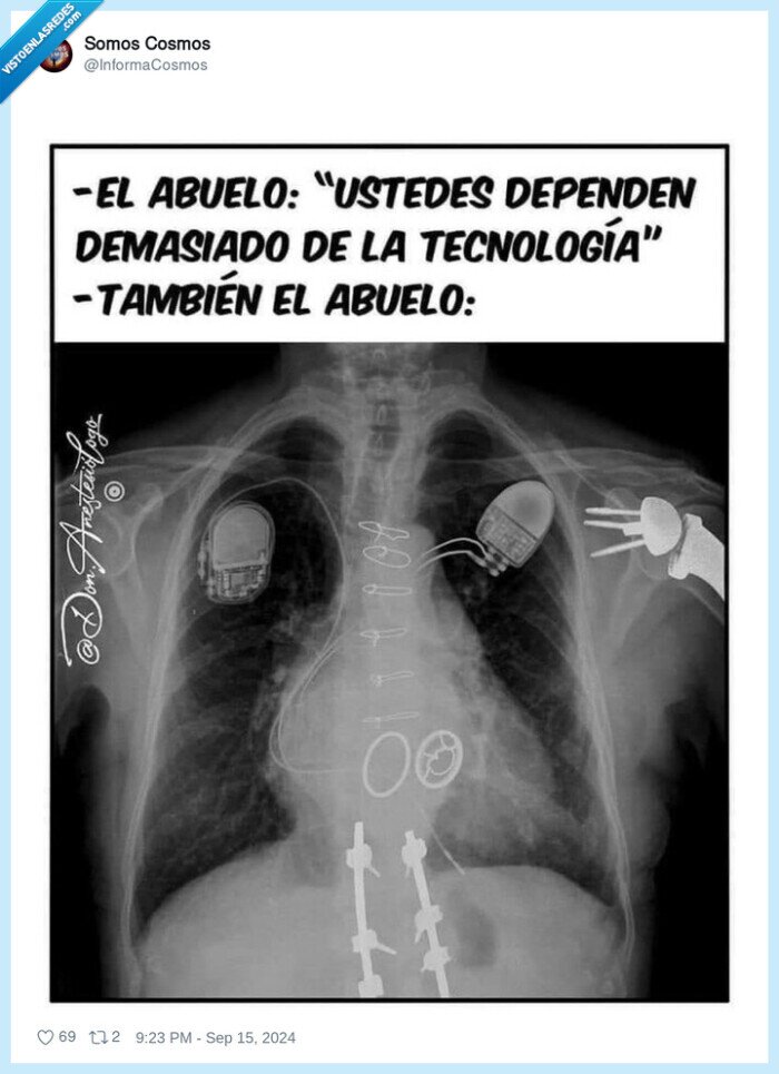 tecnología,vivo,abuelo,radiografia,cacharros