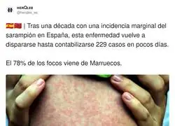 El sarampi&oacute;n vuelve a Espa&ntilde;a